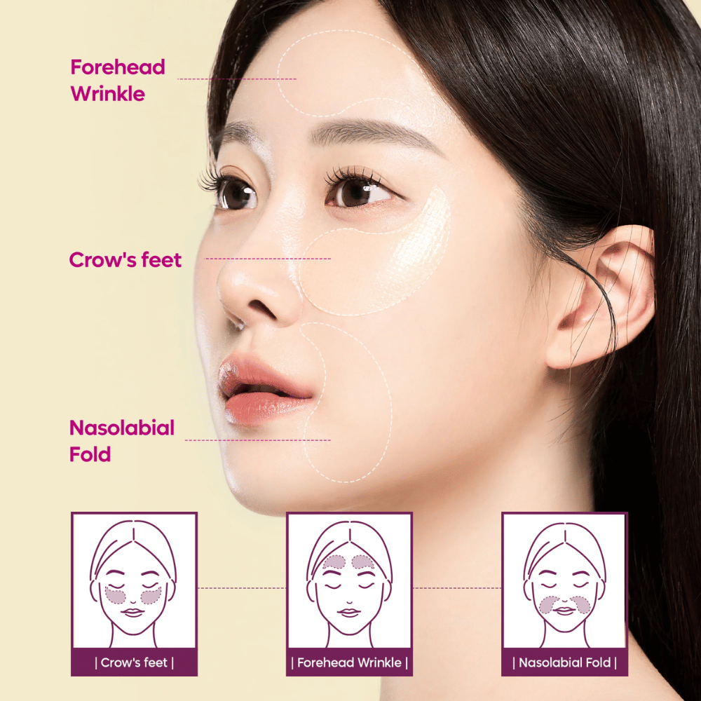 Model with eye patches placed on crow's feet, forehead, and nasolabial lines showing how Dr. Melaxin Cemenrete Calcium Volume Eye Patch can be used for wrinkles and volume loss.