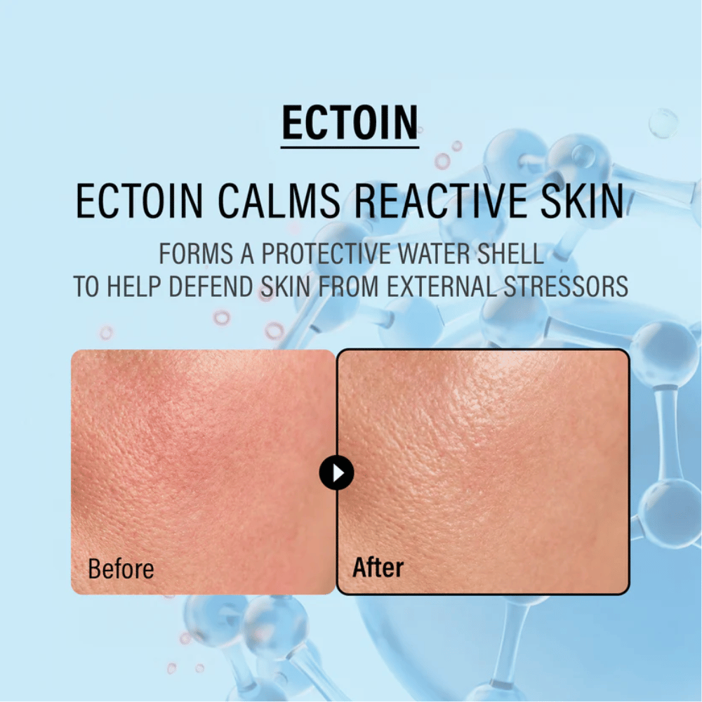 EPII Double Up Cream with ectoin that soothes sensitive skin, protects against external stressors, and strengthens the skin’s natural barrier.
