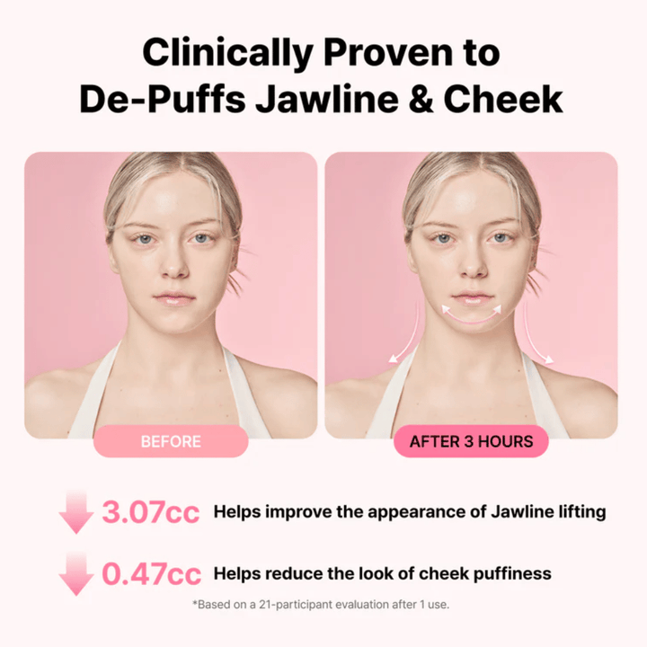 Before-and-after image illustrating improved appearance of the jawline and reduced swelling after using RETURNITY Ear Therapy Acupressure Patch for three hours.