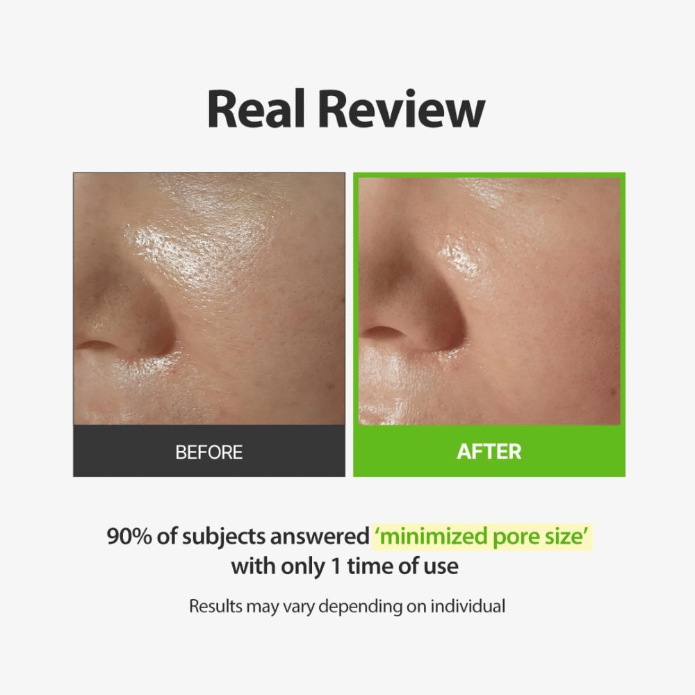 SUNGBOON EDITOR Green Tomato Pore Peeling Jumbo Pad – before-and-after image focusing on visible pores