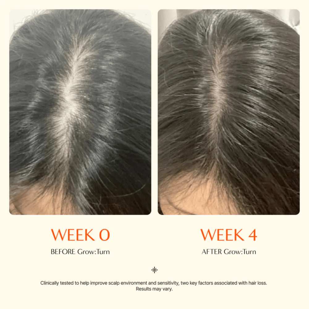 Close-up of the scalp before and after 4 weeks – a more defined hair parting that looks denser after treatment.