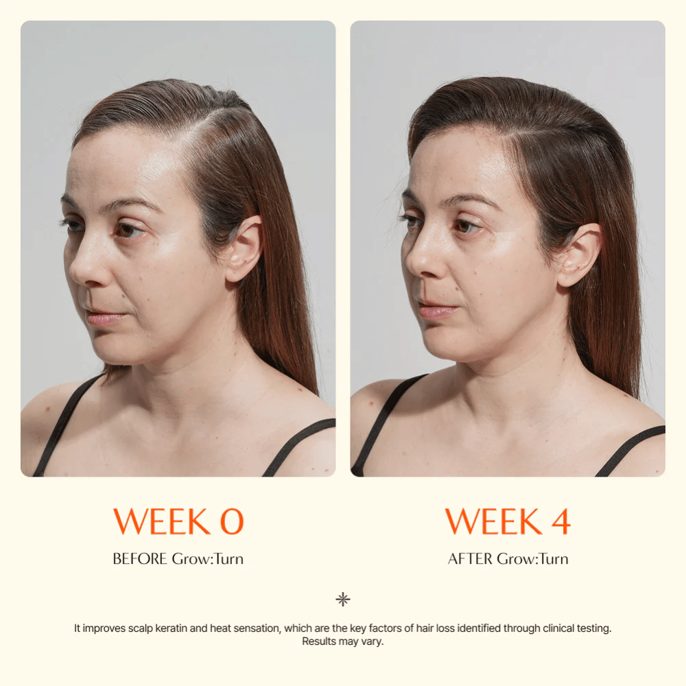 Before-and-after image of a woman (week 0 vs week 4) showing improved hair quality and a fuller feel after use.