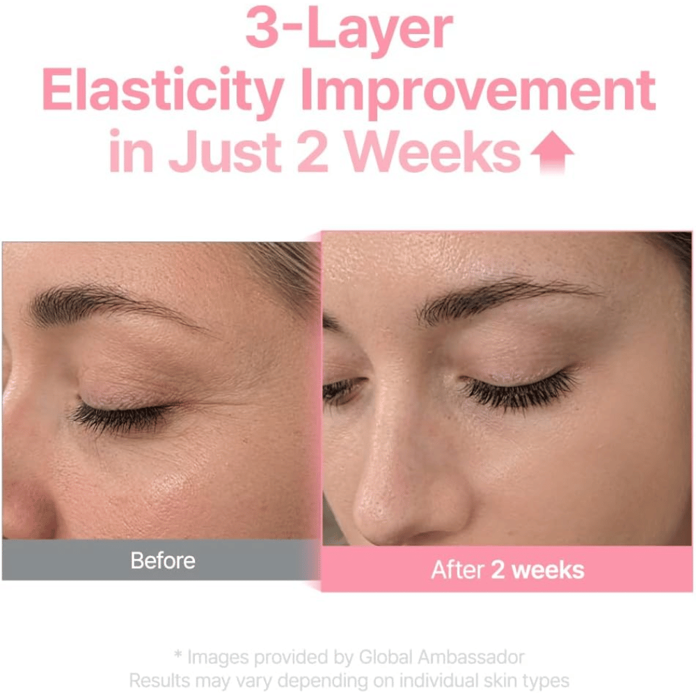 Before-and-after image for Purito Multi PDRN Collagen EGF Serum showing improved skin elasticity after two weeks.