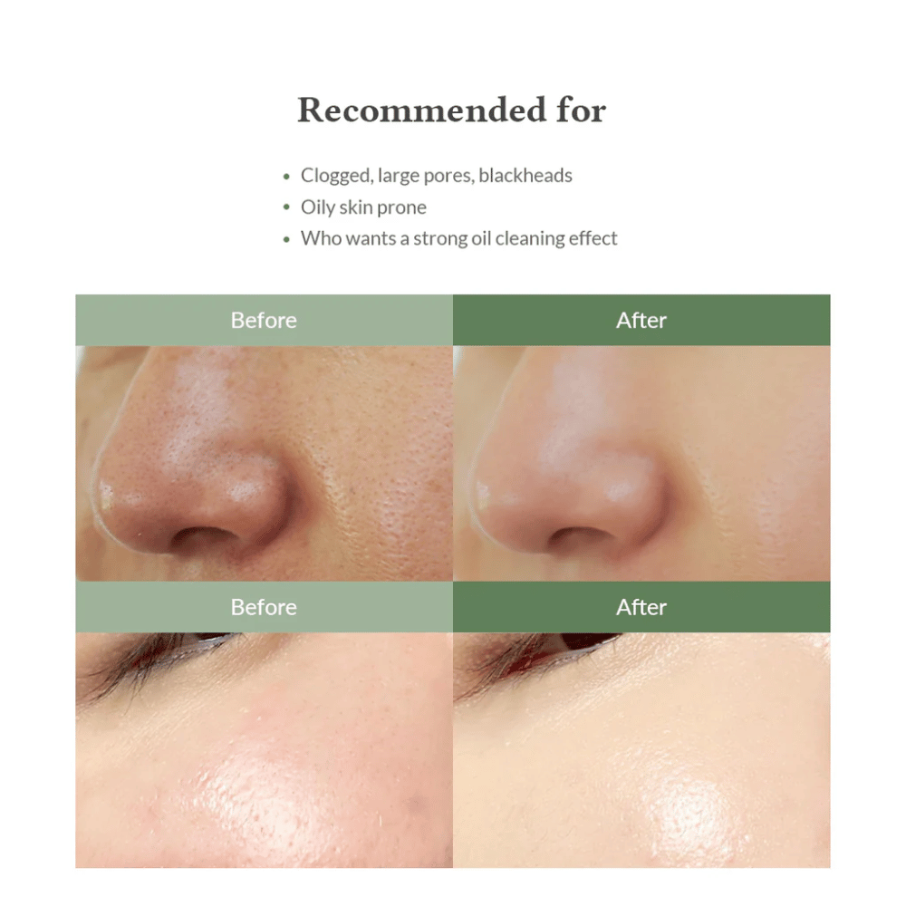 Dr. Althea Premium Quick Step Sebum Cleanser – face wash that helps reduce blackheads, deeply clean pores, and provide a smoother skin texture.