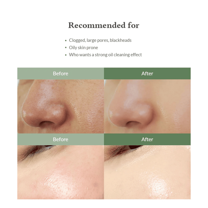 Dr. Althea Premium Quick Step Sebum Cleanser – face wash that helps reduce blackheads, deeply clean pores, and provide a smoother skin texture.