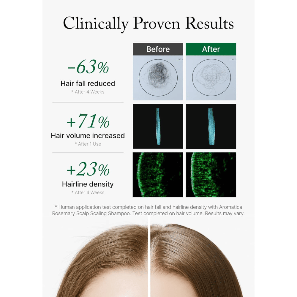 AROMATICA Rosemary Scalp Scaling Shampoo with clinically tested results that reduce hair loss, increase hair volume, and improve hair anchoring density.
